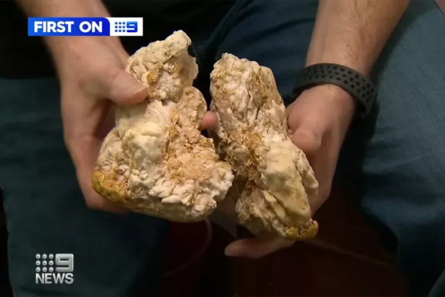 호주의 한 남성이 발견한 금이 포함된 돌덩어리. 9news 호주 방송화면 캡처