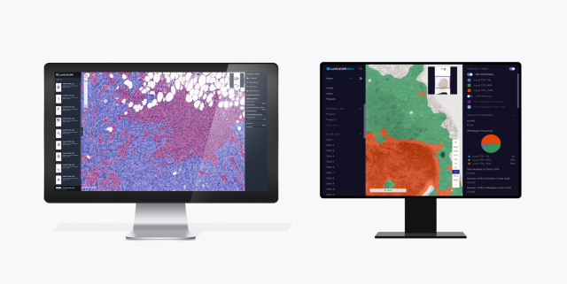 루닛 AI 바이오마커 플랫폼 '루닛 스코프 IO(왼쪽)'와 AI 병리분석 솔루션 '루닛 스코프 PD-L1' 사진 제공=루닛