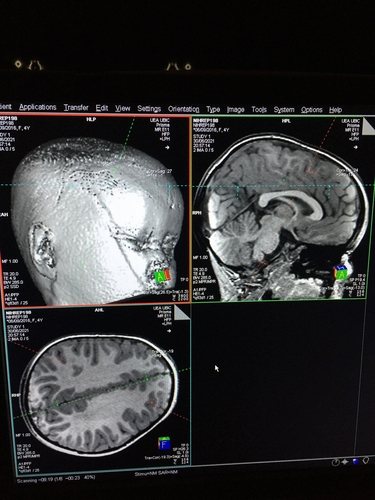 잠자는 동안 촬영한 유아의 뇌 MRI 사진이다. 사진=연합뉴스