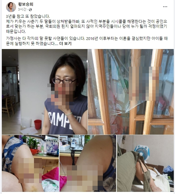 황보승희 의원이 ‘가정 폭력의 피해자’라고 주장하며 자신의 페이스북에 올린 사진. 페이스북 캡처