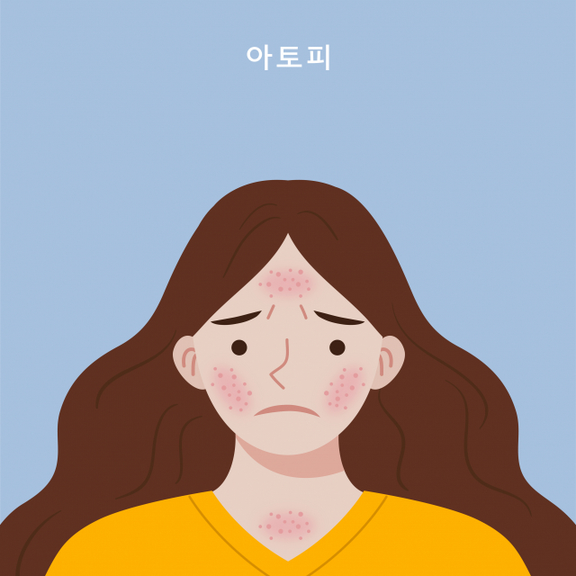 외모에 민감한 청소년기에 아토피피부염을 앓으면 자신감이 낮아지거나 대외활동, 교우관계 등이 위축되기 쉽다. 이미지투데이