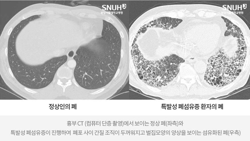 사진 제공=분당서울대병원