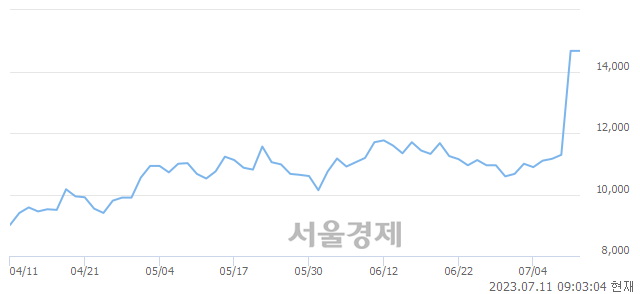 <코>덴티스, 장중 신고가 돌파.. 14,670→15,160(▲490)