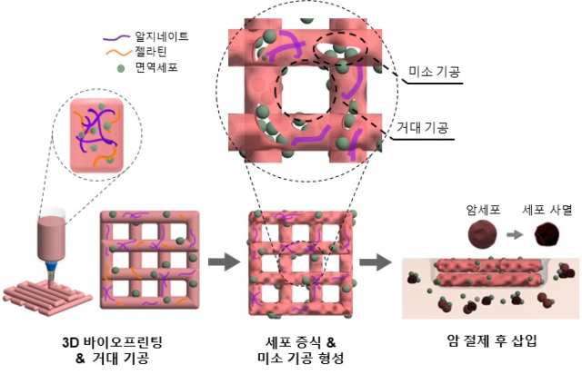 3D 바이오프린팅 NK 세포 면역 치료과정. 사진제공=한국기계연구원