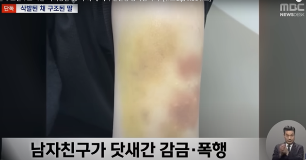 A씨는 피해여성 B씨를 닷새간 감금하고 폭행한 것으로 알려졌다. 사진=MBC 보도 캡처