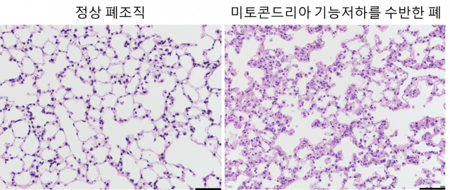 정상적인 쥐(왼쪽)와 미토콘드리아 기능이 저하된 쥐의 폐 조직. 미토콘드리아 기능이 저하된 쥐가 비정상적 상태의 폐 세포를 많이 가진 것으로 확인됐다. 사진 제공=한국연구재단