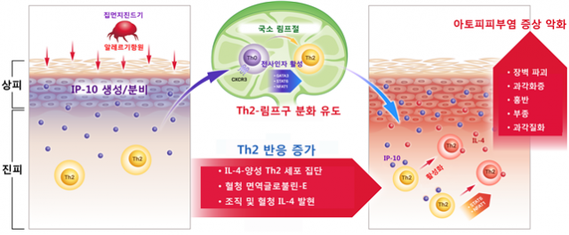 집먼지진드기가 유발한 아토피피부염 환자의 피부에서 IP-10 인자의 생산과 그 작용을 설명한 그림. 사진 제공=한국연구재단