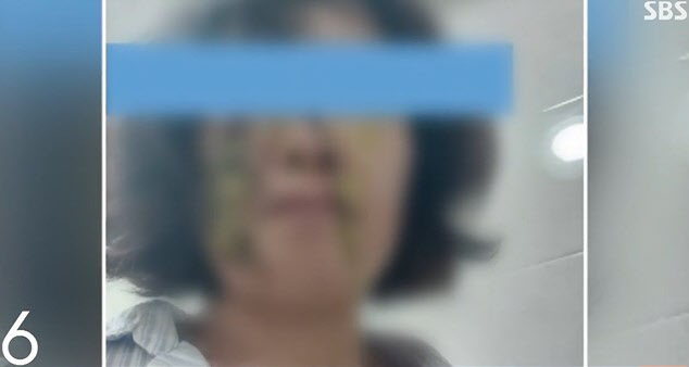 지난 10일 학부모로부터 ‘똥싸대기’를 맞은 어린이집 교사의 모습. 사진=SBS '모닝와이드' 방송화면 캡처