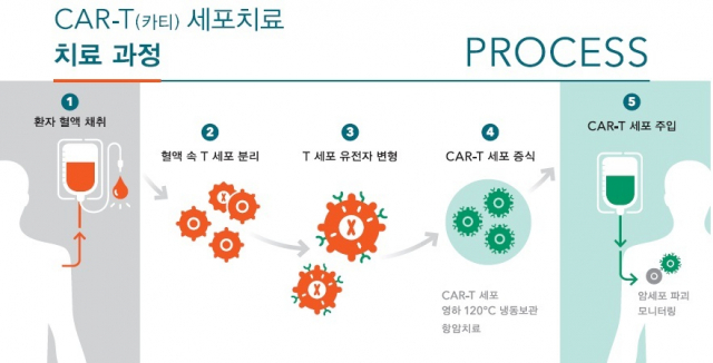 카티세포치료 모식도. 모식도=울산대학교병원