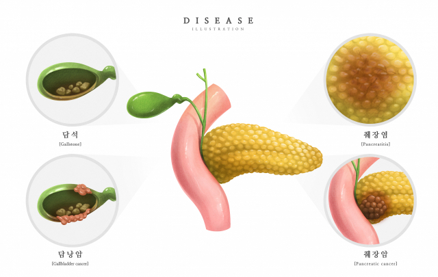 사진은 기사와 직접적인 관련이 없습니다. 사진=이미지투데이