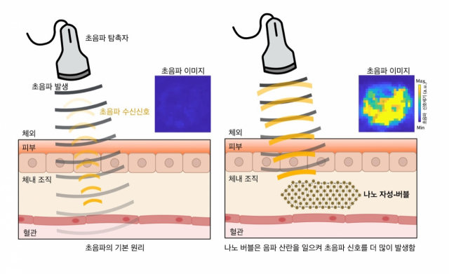 기존 초음파 진단(왼쪽)과 나노 자성버블을 활용해 신호 세기를 증폭한 초음파 진단을 비교한 그림. 사진 제공=IBS