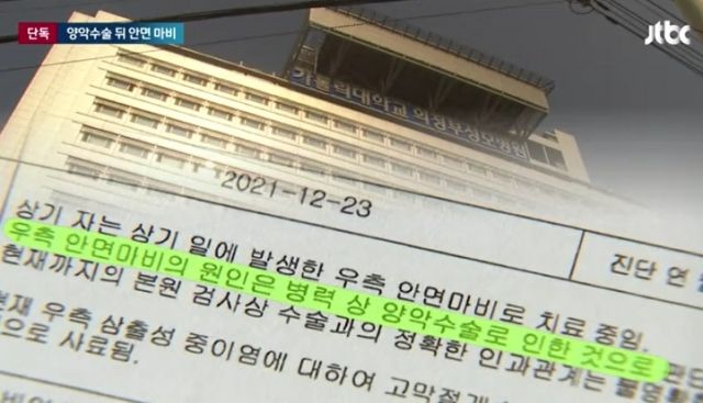 대학병원은 문제의 성형외과 진료 행위를 안면마비 원인으로 진단했다. jtbc 보도화면 캡처