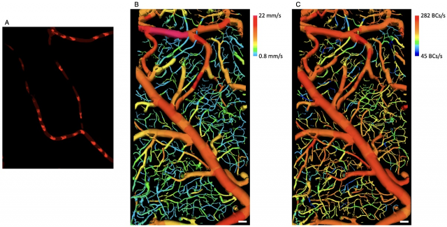 오왕열 KAIST 기계공학과 교수 연구팀이 개발한 기술로 촬영한 혈관 속 적혈구들(왼쪽). 초당 흐르는 적혈구 개수까지 수치로 나타내준다(맨 오른쪽). 사진 제공=KAIST