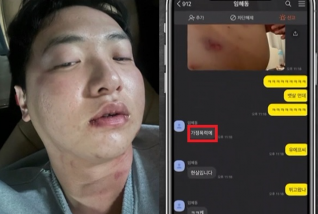 임씨가 김씨에게 폭행당했다며 공개한 사진(왼쪽)과 디스패치가 