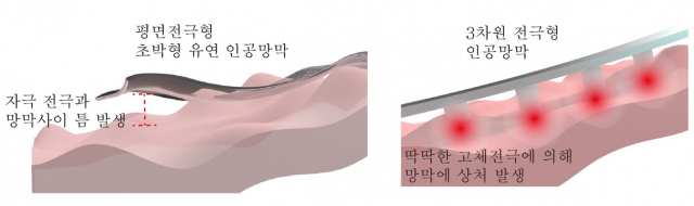 기존 고체 금속 기반의 평면 전극형(왼쪽)·3차원 전극형 인공망막의 한계. 사진 제공=연세의료원