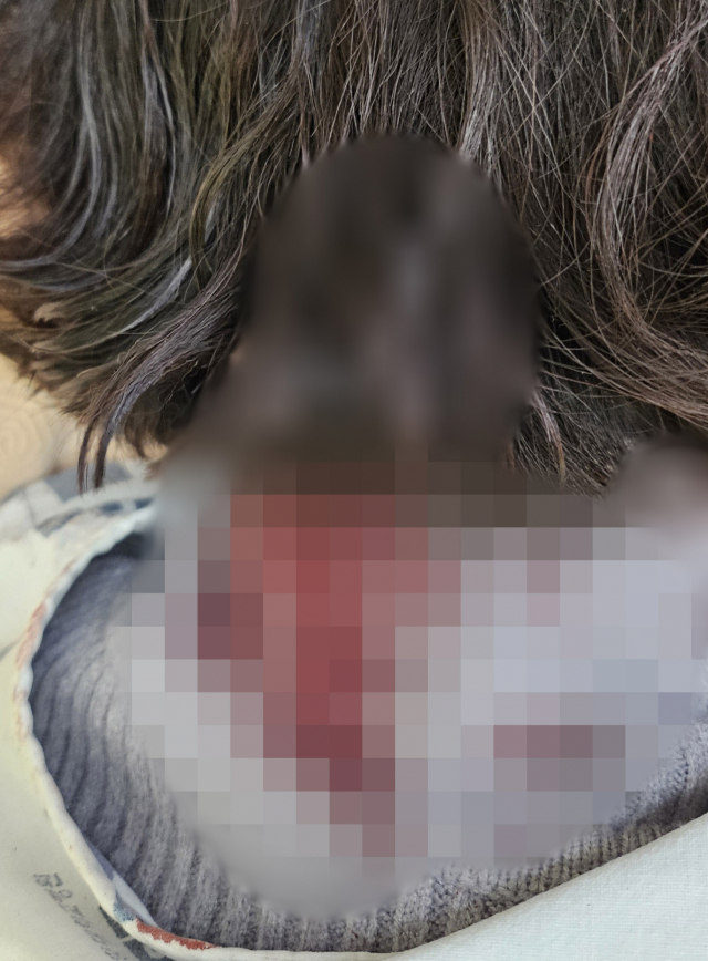 배현진 의원 피습 직후 촬영된 사진. 회색 니트의 목주변에 다량의 혈흔이 묻어 있다. 제공=배현진 의원실