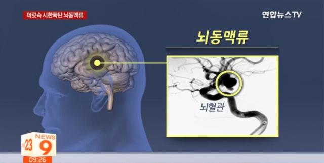 연합뉴스TV 보도화면 캡처