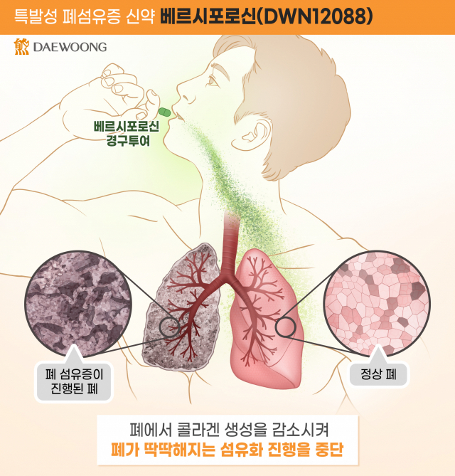 베르시포로신 작용 기전. 사진 제공=대웅제약