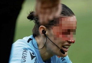 얼굴 피투성이 된 여성 심판 '응급 수술'…스페인 프로축구서 무슨 일?