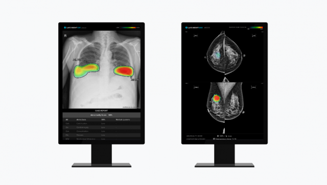 루닛 인사이트 CXR(왼쪽)과 루닛 인사이트 MMG. 사진 제공=루닛