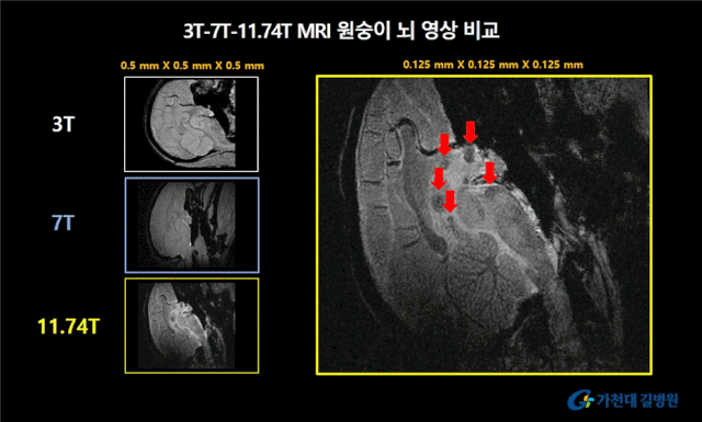 3T, 7T, 11.74.T로 각각 촬용한 MRI 원숭이 뇌 영상. 사진제공=가천대 길병원