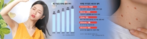 1년 중 자외선 가장 강한 계절, 햇빛알레르기·피부암 주의하세요