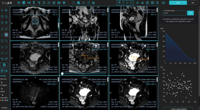 제이엘케이의 전립선암 진단 인공지능(AI) 솔루션 ‘메디허브 프로스테이트’ 화면. 사진 제공=제이엘케이