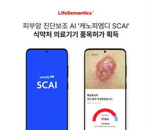 스마트폰 카메라로 찍으면 피부암 잡는 AI, 국내 첫 허가