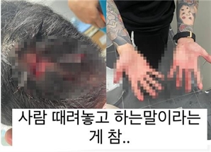 "도찰 사진 지워 달랬더니 때렸다"…팔로워 39만명 '틱톡커' 폭행한 20대 입건