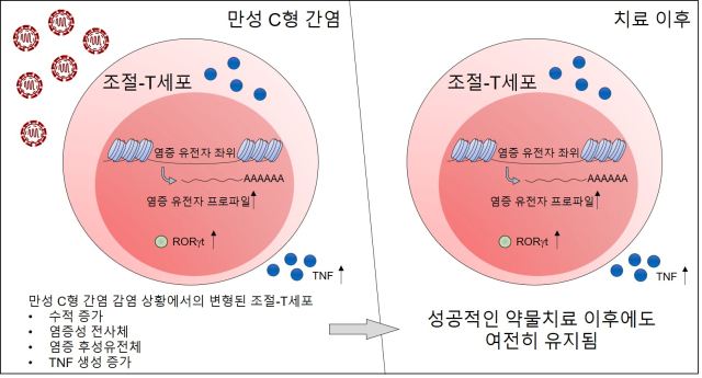 만성 C형 간염 환자의 항바이러스제 약물치료 이후에도 조절 T세포에 염증성 흔적이 남는다는 연구 결과. 사진제공=IBS