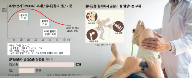 “너무 좋아져도 탈” 골다공증 치료의 딜레마, 사라졌다