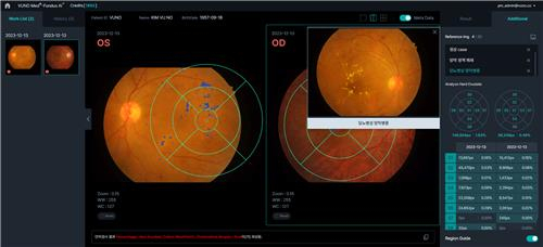 뷰노, 국제 의료 AI 대회서 녹내장 판독 분야 1위