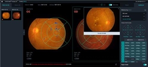 뷰노, 국제 의료 AI 대회서 녹내장 판독 분야 1위