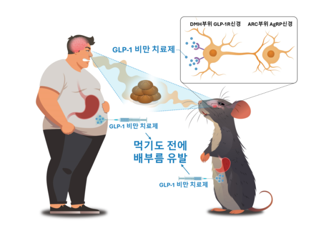 비만 원인·치료 실마리, 뇌에서 찾는다