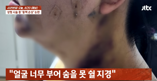 성형외과서 지방흡입술 하다 '동맥 손상'…'죽을 뻔' 따지자 의사가 꺼낸 말