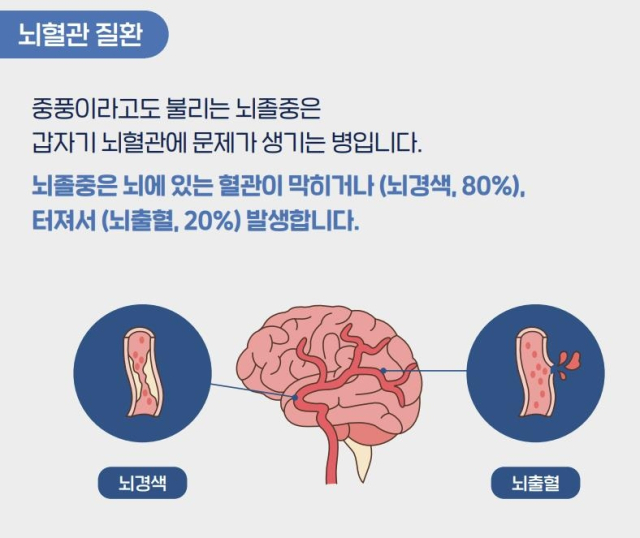 “이웃·손·발·시선” 뇌졸중 걱정된다면…이것만큼은 꼭 [헬시타임]