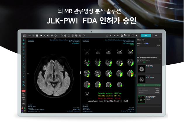 제이엘케이 뇌관류 MR 영상 분석 솔루션 ‘JLK-PWI’. 사진 제공=제이엘케이