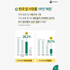 독일, AI 폐암 검진 의무화… 유럽 의료 AI 시장 판도 바뀐다