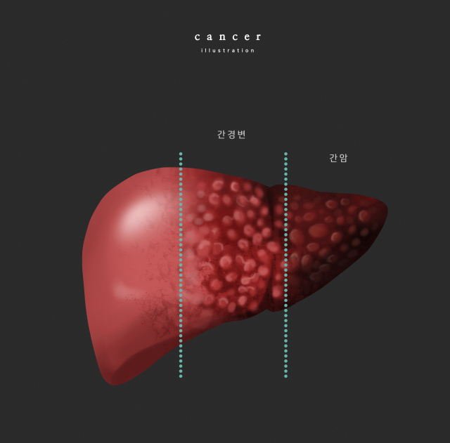 I heard that liver cancer is scary… Don’t worry less if you get this test twice a year [건강 팁]