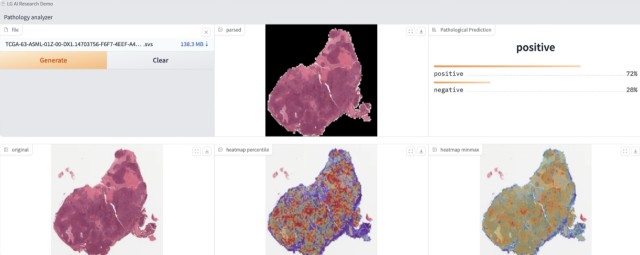 LG AI연구원의 암 진단과 치료를 위한 새로운 병리학 파운데이션 모델 ‘엑사원패스’ 시연 장면. 사진제공=AWS