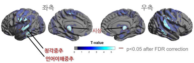 노인 2명 중 1명이 겪는 ‘이 증상’ 치매 위험도 높인다는데 [건강 팁]