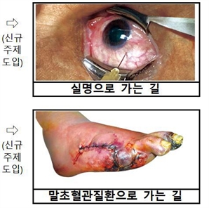 "폐암으로 가는 길" 담뱃갑 경고 문구·그림 더 독해진다