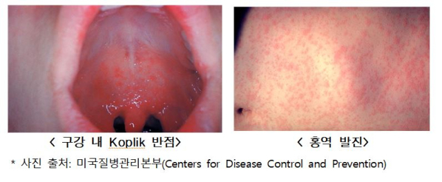 사진제공=질병청