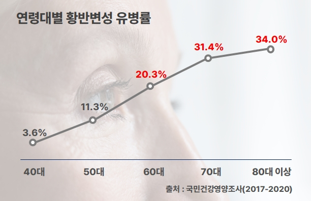 연령대별 황반변성 유병률. 사진 제공=분당서울대병원·국민건강영양조사