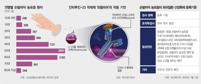 “신발 신는 것도 고통” 손발바닥 농포증 환자들, 희망 찾았다 [메디컬 인사이드]