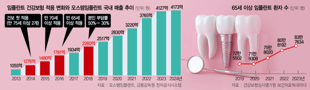 임플란트 건보 ‘2개→4개’ 늘리면 1.8조 더 들어…재정부담 가중