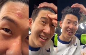 "우승 트로피에 박았어요"…'무관 탈출' 손흥민, 이마 긁혀도 싱글벙글
