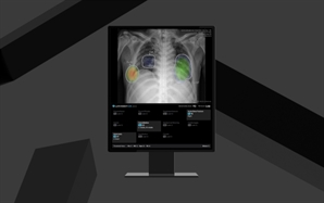 루닛, AI 흉부 엑스레이 진단 솔루션 'CXR4' 유럽 CE MDR 인증 획득