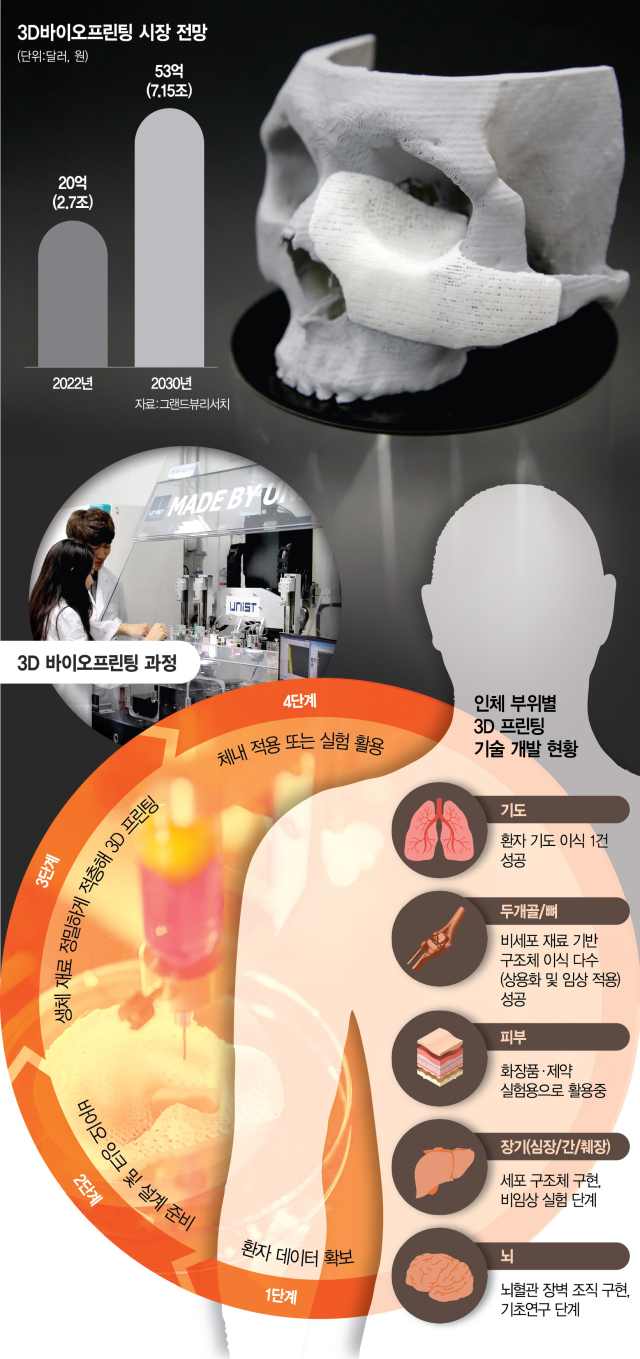 손상된 심장·함몰된 두개골…'3D 프린팅'으로 되살린다[사이언스 포커스]