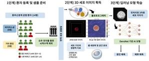 중추신경계 감염 환자, 이젠 원인도 예후도 AI로 예측한다 [헬시타임]